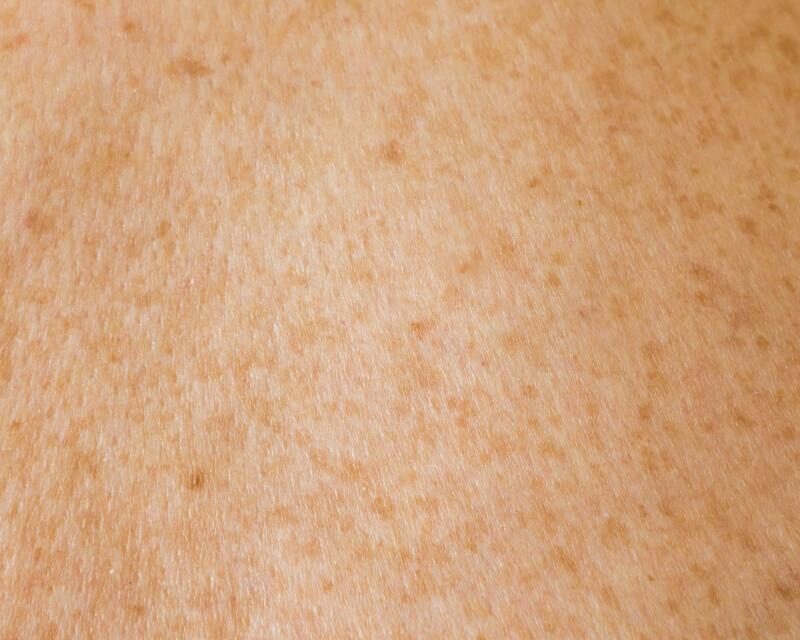 Dettaglio della pelle: influenza del collagene