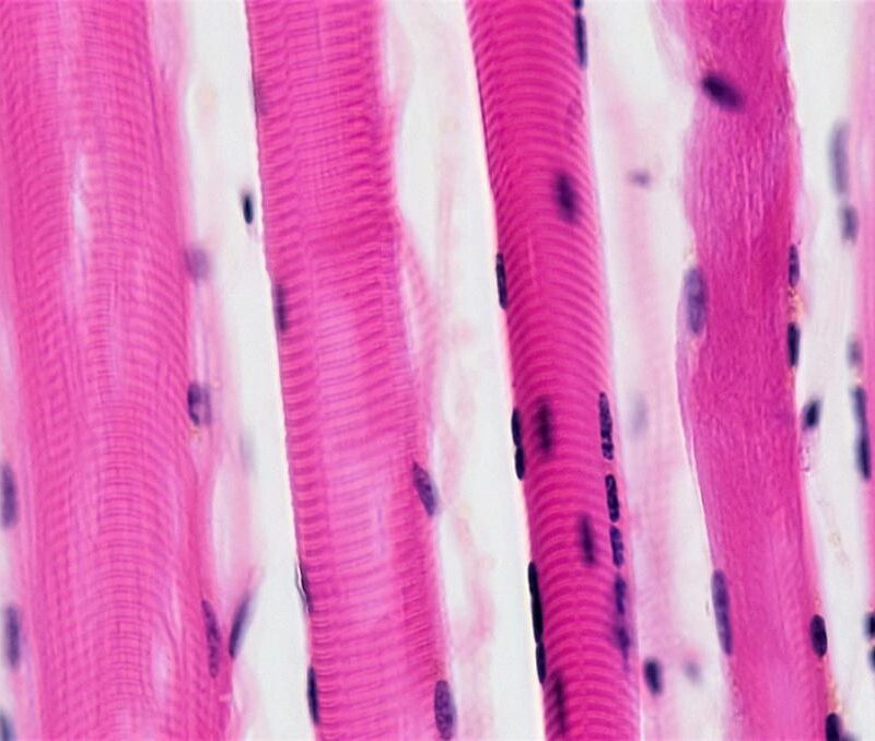fibre muscolari