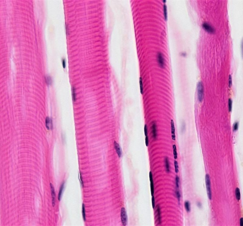 fibre muscolari