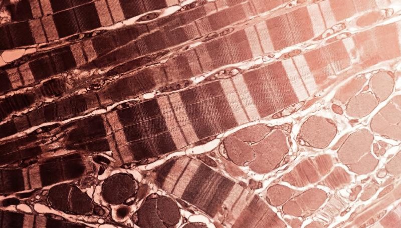 Micrografia di un tessuto cellulare nei toni del rosso corallo e marrone scuro, con una transizione visiva da fibre disorganizzate a un pattern lineare e luminoso.