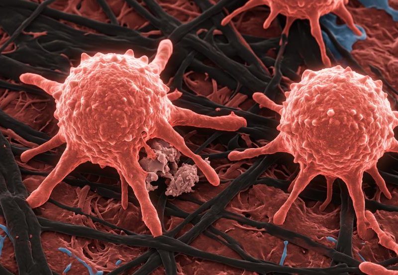Microscopia elettronica ultra-realistica di un macrofago attivo del sistema immunitario in toni nero (#2D2926) e corallo (#E5554F), simbolo di longevità cellulare e prevenzione dell'immunosenescenza.
