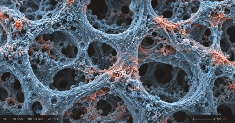 Micrografia al microscopio elettronico della matrice ossea trabecolare nei colori nero e blu corallo GenAge, che illustra visivamente la densità ossea e il continuo rimodellamento cellulare alla base di ossa forti.
